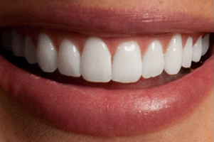 teeth_02.jpg